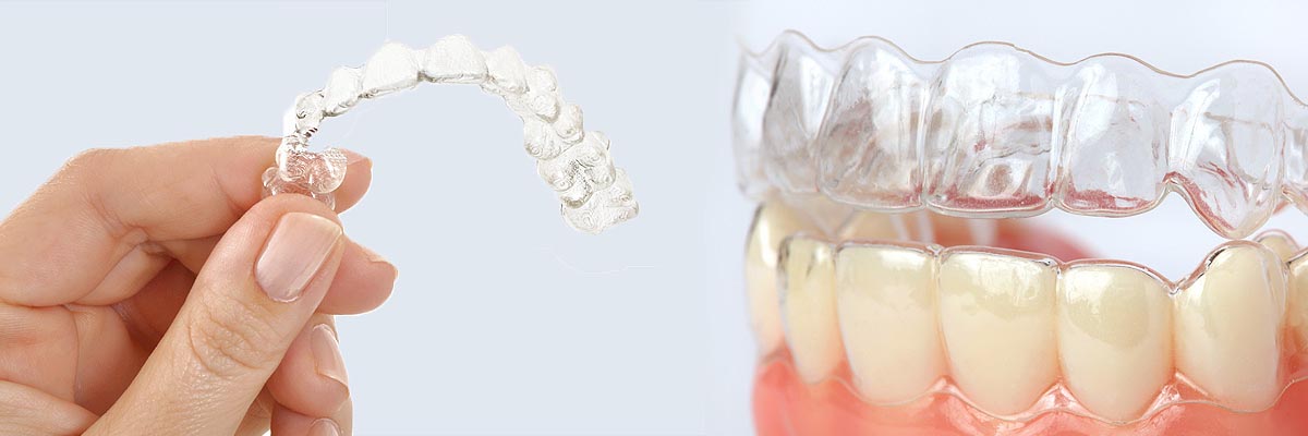 Dunwoody Alternative to Braces for Teens