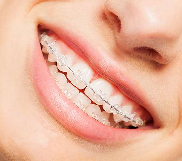 Dunwoody Invisible Orthodontics