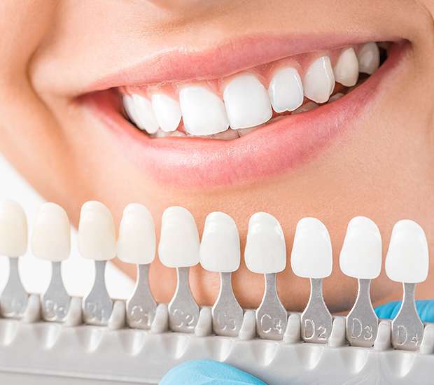 Dunwoody Cosmetic Dentist