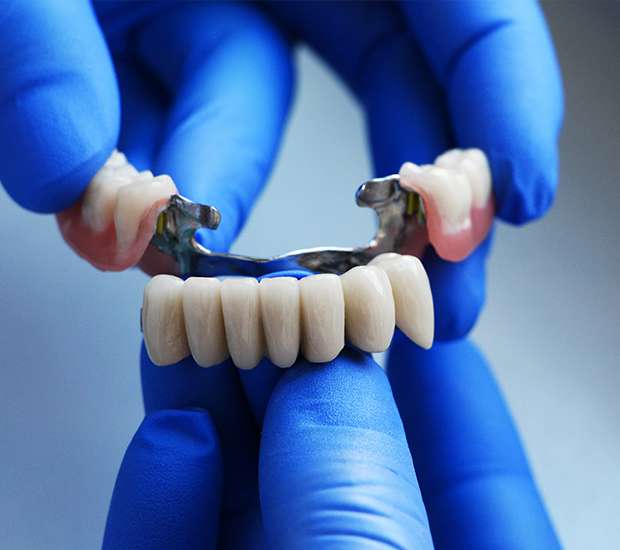 Dunwoody Dental Bridges