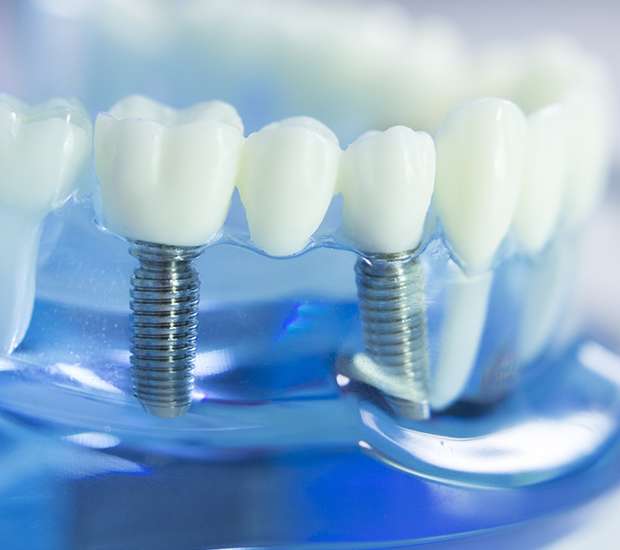 Dunwoody Dental Prosthetics