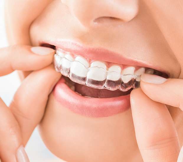 Dunwoody Does Invisalign® Really Work?
