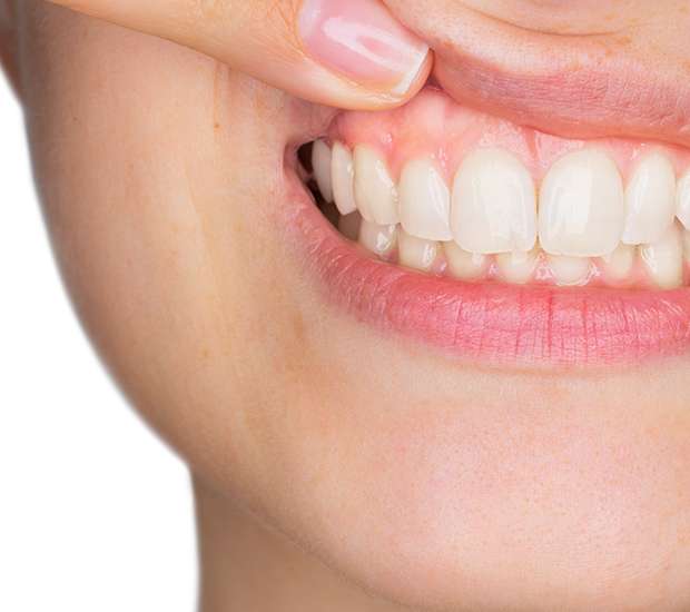 Dunwoody Gum Disease