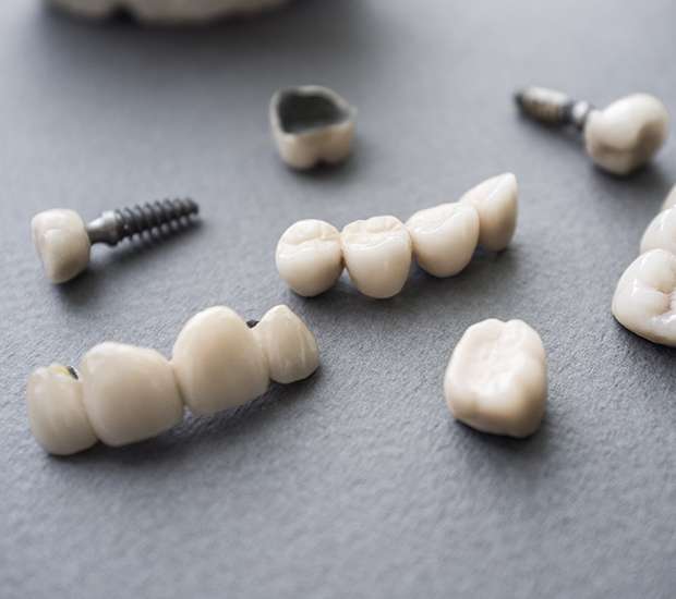 The Difference Between Dental Implants and Mini Dental Implants
