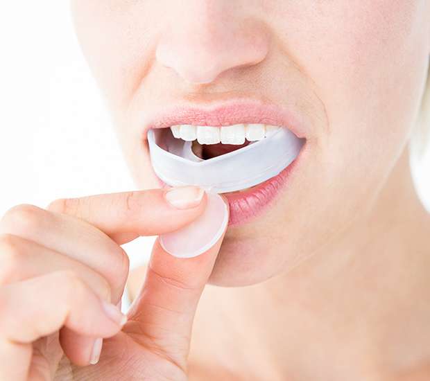 Dunwoody Mouth Guards